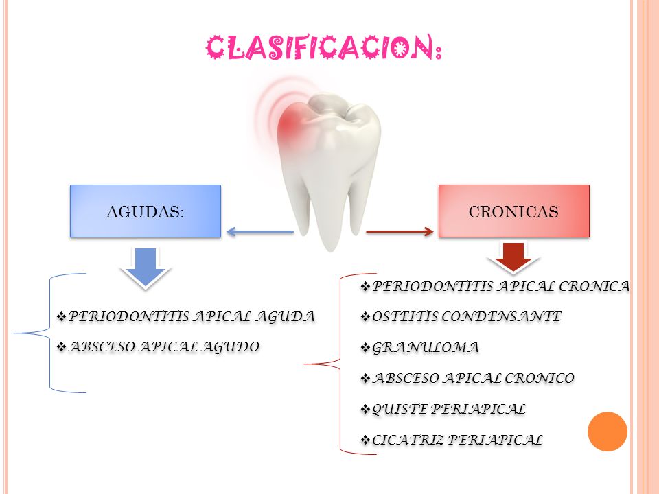 Signos y sintomas de periodontitis apical aguda